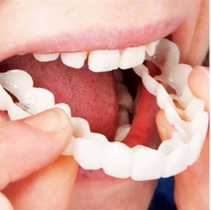 HappySmile™ — Reusable Veneer Set (Top & Bottom)
